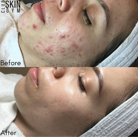 Image of Introductory Offer- Skin Rejuvenation Process