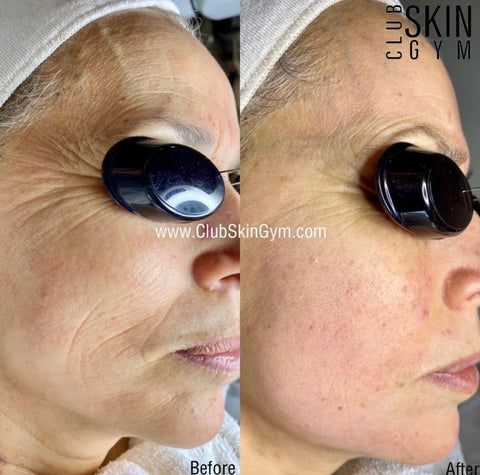 Image of Introductory Offer- Skin Rejuvenation Process