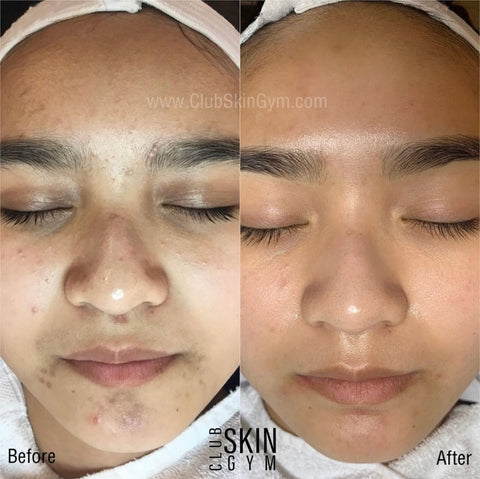 Image of Introductory Offer- Skin Rejuvenation Process