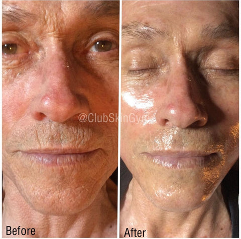 Image of Introductory Offer- Skin Rejuvenation Process
