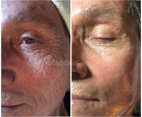 Image of Introductory Offer- Skin Rejuvenation Process